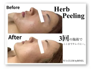 BINEL REINAのネイルデザイン