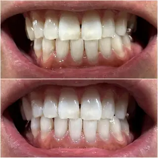 ホワイトニングジム 池袋のその他イメージ