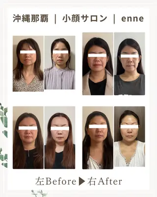 小顔サロンenne所属・小顔サロンenne 【エンネ】のその他イメージ