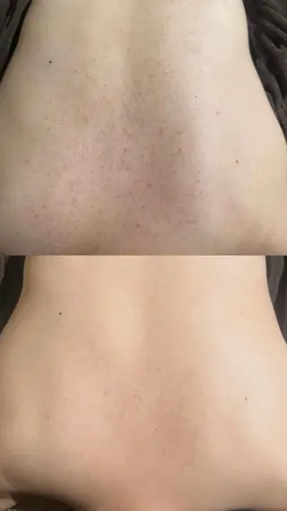 エミルカ 自由が丘店所属・花島 悠のエステ・リラクイメージ