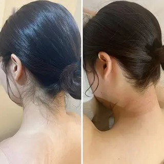 うなじ脱毛/美肌脱毛 LABELのエステ・リラクイメージ