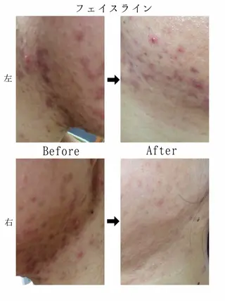 KalanDiva〜 ｶﾗﾝﾃﾞｨｰﾊﾞ〜のエステ・リラクイメージ