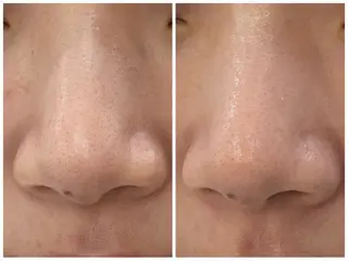 NARIS BEAUTY STATION　デ・アイム あべのルシアス所属・佐伯 心香のエステ・リラクイメージ