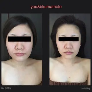 キッズ You&i(ユーアイ)所属・Nomura Suuのエステ・リラクイメージ