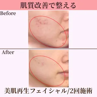 Belle White所属・本格痩身＊透明美肌 BelleWhiteのエステ・リラクイメージ