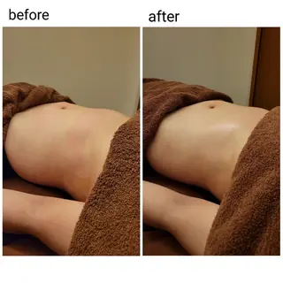 ラジオ波温活エステ✨ yumiのエステ・リラクイメージ