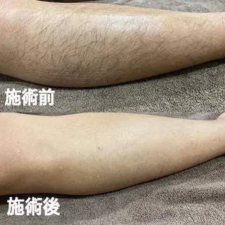 メンズ GALANTE beautysalon所属・泰中 郁未のエステ・リラクイメージ