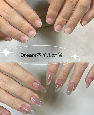 ネイル ネイリストゆか💅 長さだし、深爪矯正のネイルデザイン