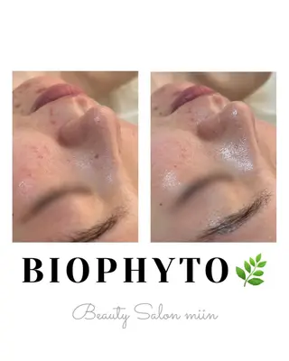 韓国肌管理 白玉肌管理®︎のエステ・リラクイメージ