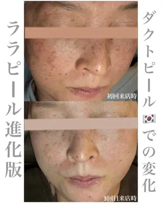 chouchou【シュシュ】所属・トータルボディケア chouchouのエステ・リラクイメージ