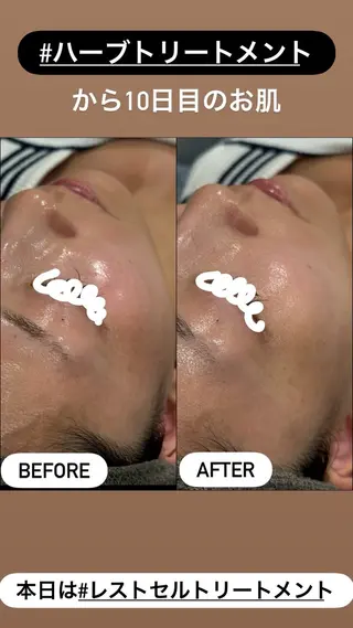 LiZA エステティックサロンのエステ・リラクイメージ