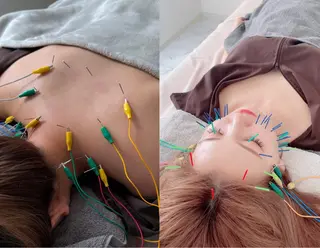 美容鍼＆鍼灸サロン 鍼Glitter.所属・田中 美奈のエステ・リラクイメージ