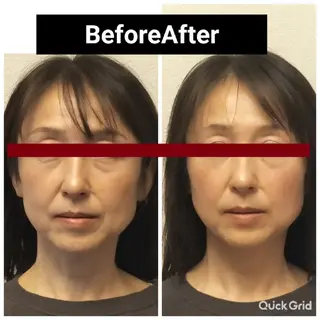 美容矯正 QUICO【キコ】のその他イメージ