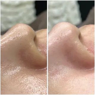 re.make所属・小顔美肌💖痩身☃️ ユキナ🤍のエステ・リラクイメージ