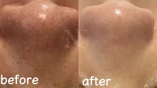 Nature Souce毛穴専門店のその他イメージ