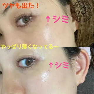 Rim リムのマツエク・マツパデザイン