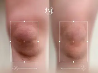 MOMO BEAUTY所属・Momo beautyのその他イメージ