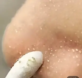 角栓取り専門エステ ベテラン講師幸田のエステ・リラクイメージ