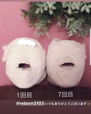 毛穴ケア くすみ肌 ハーブピーリングのエステ・リラクイメージ