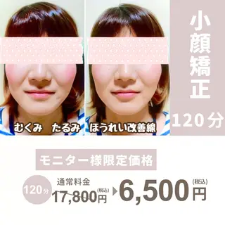 小顔矯正& 慢性肩こり腰痛改善店のエステ・リラクイメージ