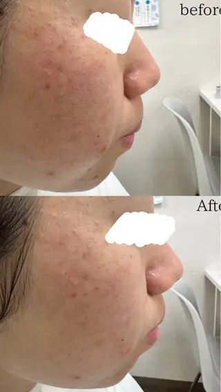 デ・アイム塚口所属・肌質/体質改善 久下玲菜のエステ・リラクイメージ