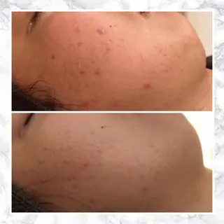 ショート カラー パーマ ヘアアレンジ メンズ キッズ ネイル マツエク・マツパ アイブロウ 触れたくなる モテ肌へ...❤︎のエステ・リラクイメージ