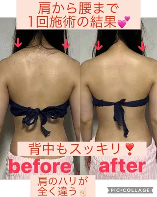 salon de blue rose所属・ハイパーナイフ専門 熊田陽子のエステ・リラクイメージ