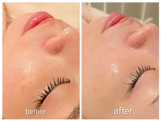 SalonThePumalo所属・Yamada Sachikoのエステ・リラクイメージ