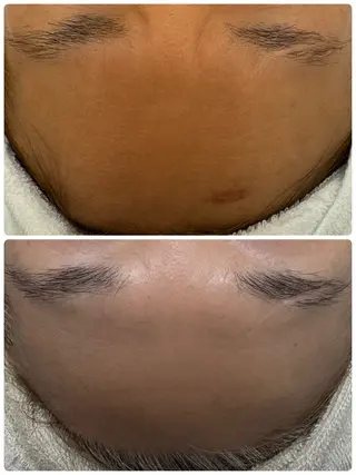 シミ毛穴専門店 yucca(ユッカ)のエステ・リラクイメージ