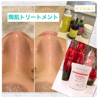 【リベルハーブピーリング認定店】敏感肌・美白脱毛専門店Dione立川店所属・Dione 立川店のエステ・リラクイメージ