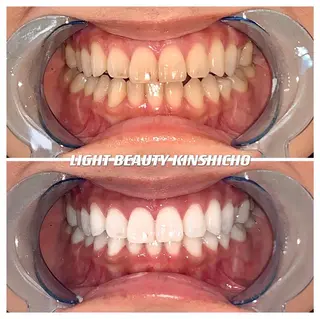 メンズ ライトビューティー 錦糸町店のエステ・リラクイメージ