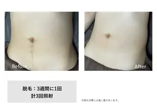 RIKKA所属・RIKKA☆脱毛/ アイブロウ/メイクのエステ・リラクイメージ