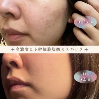 NONOKEKE ノノケケのエステ・リラクイメージ