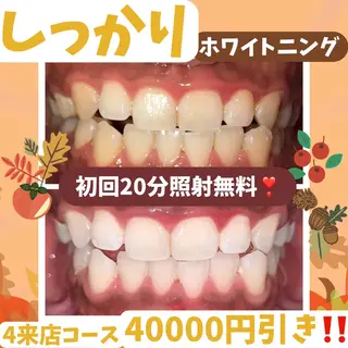 ホワイトニング|韓国式3D毛穴洗浄 lonhana ロンハナ所属・韓国式3D毛穴洗浄 lonhanaのその他イメージ