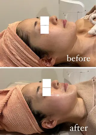 RAY Beauty エステ　一宮店のエステ・リラクイメージ