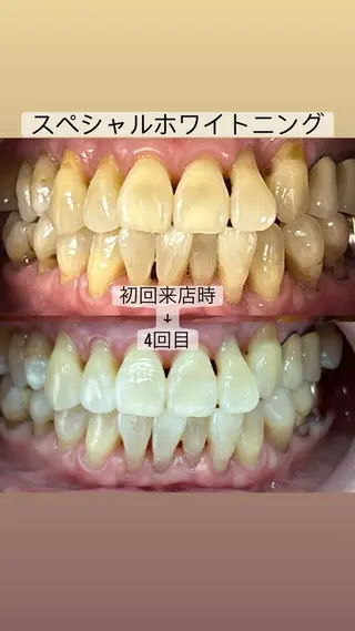 whitening salon yatto.所属・ホワイトニングサロン yatto.のその他イメージ