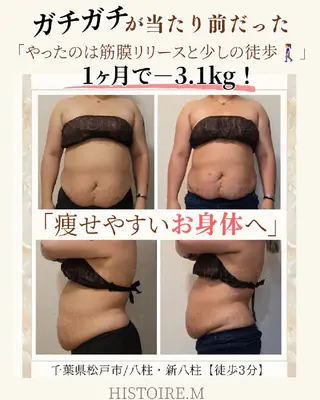 HISTOIRE.M イストアールエム所属・ダイエット/体質改善 /筋膜リリース専門店のエステ・リラクイメージ