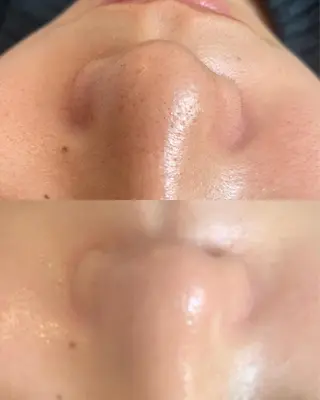 VERY VERY九条店所属・VERY VERY 九条店のエステ・リラクイメージ