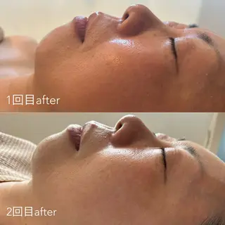 エステティックサロン Liente(リアンテ)所属・Hashimoto .のエステ・リラクイメージ