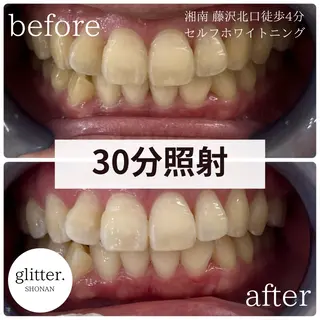 glitter.SHONAN所属・佐久間 茉弥のエステ・リラクイメージ