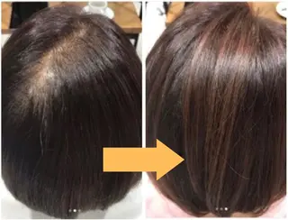 bellissimo 【ベリッシモ】所属・ちひろ　痩身/ハーブ bellissimoのエステ・リラクイメージ