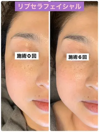 Private Salon Prunelle所属・プライベートサロン プリュネルのエステ・リラクイメージ