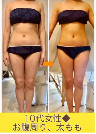 ショート カラー パーマ ヘアアレンジ メンズ キッズ ネイル マツエク・マツパ ‍痩身＆ボディ 結果出し🌟丹野のエステ・リラクイメージ