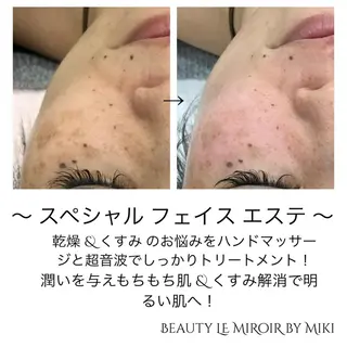 ビューティー ミロワールのエステ・リラクイメージ