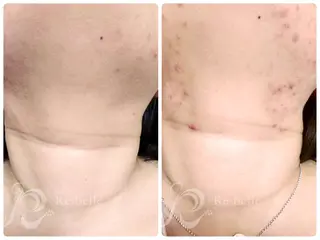 ハーブピーリング専門 BIOPLUS＋川崎のエステ・リラクイメージ