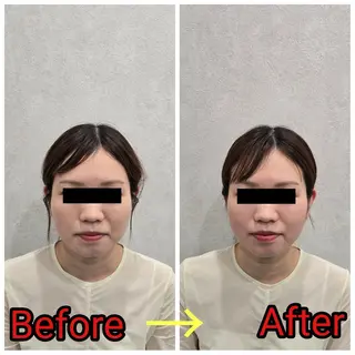 小顔矯正・美容鍼 FLOW鍼灸整体院のエステ・リラクイメージ