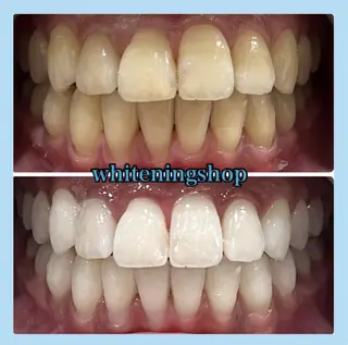 ホワイトニング ショップ千葉店のその他イメージ