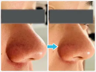 中目黒  整体 小顔 KUOKOAのエステ・リラクイメージ