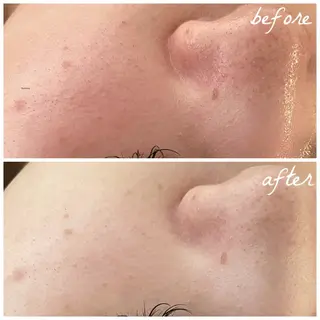 メンズ メナード岐阜市茜部 杉浦のエステ・リラクイメージ