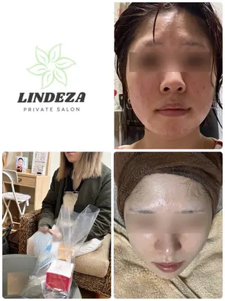 private salon 𝐋𝐈𝐍𝐃𝐄𝐙𝐀所属・LINDEZA Ayaのエステ・リラクイメージ